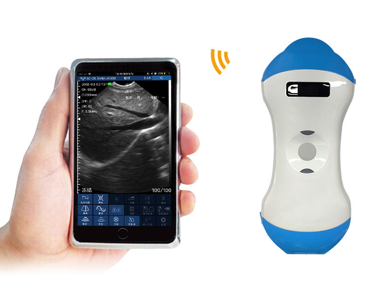 3-in-1 Wireless Colour Doppler Ultrasound